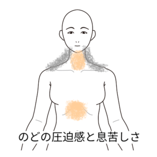 鍼灸の症例「夜間に悪化する喉の圧迫感と胸の息苦しさ」（名鉄桜井駅/愛知県安城市）