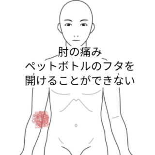 鍼灸の症例「捻る、握る、持ち上げるのが辛い」（名鉄桜井駅/愛知県安城市）