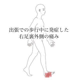 鍼灸の症例「出張での歩行中に発症した右足裏外側の痛み」（清澄白河）