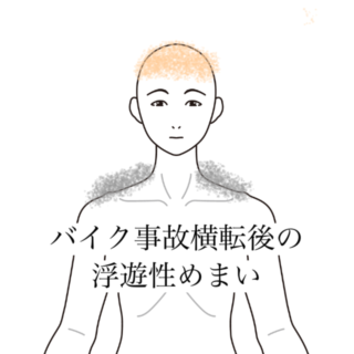 鍼灸の症例「バイク事故後の頭全体のふわふわしためまいと首の動きの制限」（有松駅）