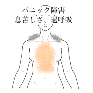 鍼灸の症例「勉強中に悪化する息苦しさと過呼吸」（有松駅）