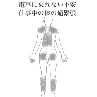 鍼灸の症例「仕事中の過緊張で急に不安が出てくる症状」（有松駅）