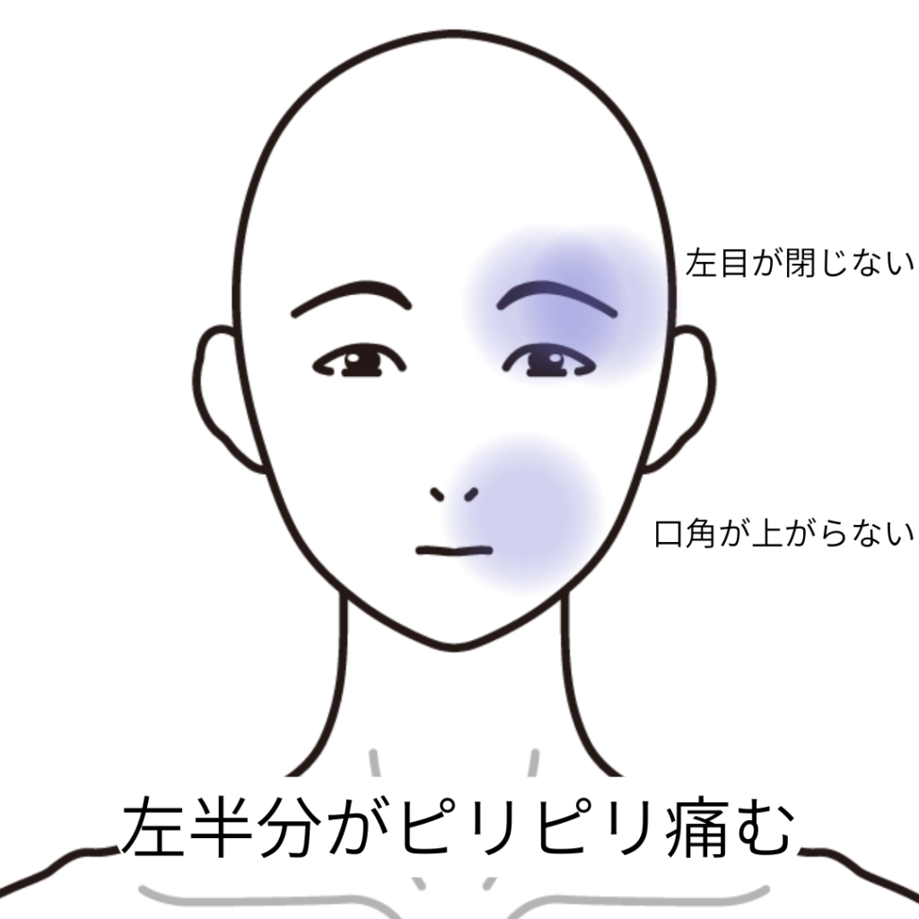 顔 が ピリピリ する