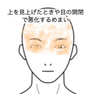 鍼灸の症例「上を見上げたときや目の開閉で悪化するめまい」（JR品川駅／東京都品川区）