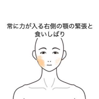 鍼灸の症例「常に力が入る右側の顎の緊張と食いしばり」（JR品川駅／東京都品川区）