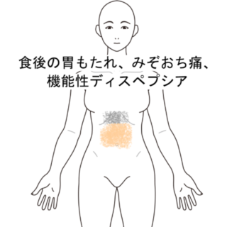 鍼灸の症例「食後の胃もたれ、みぞおち痛、機能性ディスペプシア」（阪急三国駅/大阪市淀川区）