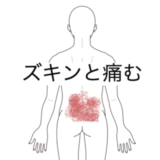 鍼灸の症例「しゃがむ動作と寝返りで悪化する慢性腰痛の1症例1845」（愛知県あま市 / 名鉄七宝駅）
