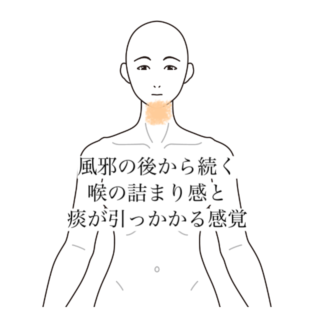 鍼灸の症例「風邪の後から続く喉の詰まり感と痰が引っかかる感覚」（清澄白河）