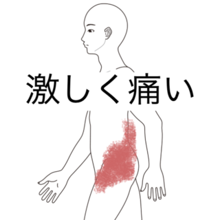 鍼灸の症例「座ると痛む左腰部から股関節の痛みの1症例」（愛知県あま市 / 名鉄七宝駅）