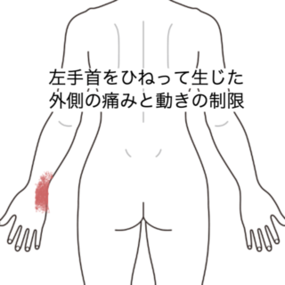 鍼灸の症例「左手首をひねって生じた外側の痛みと動きの制限」（JR品川駅／東京都品川区）