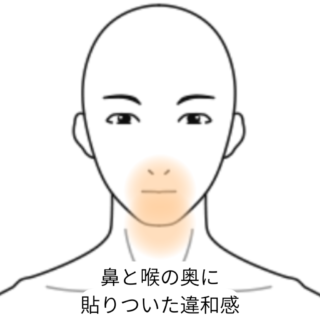 鍼灸の症例「のどの奥に痰みたいなものが貼りつき続ける」（JR千里丘駅／大阪府吹田市）