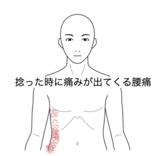 鍼灸の症例「腰を捻った時の痛み」（清澄白河）