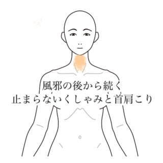 鍼灸の症例「風邪の後から続く止まらないくしゃみと首肩こり」（清澄白河）