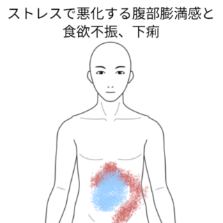 鍼灸の症例「ストレスで悪化する腹部膨満感と食欲不振、下痢」（名古屋市営地下鉄　東山線　池下駅/名古屋市千種区）
