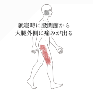 鍼灸の症例「就寝時に股関節から大腿外側に痛みが出る」（清澄白河）