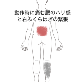 鍼灸の症例「動作時に痛む腰のハリ感と右ふくらはぎの緊張」（JR品川駅／東京都品川区）