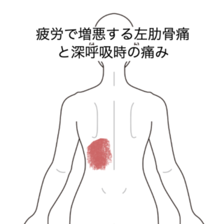 鍼灸の症例「疲労で増悪する左肋骨痛と深呼吸時の痛み」（JR品川駅／東京都品川区）