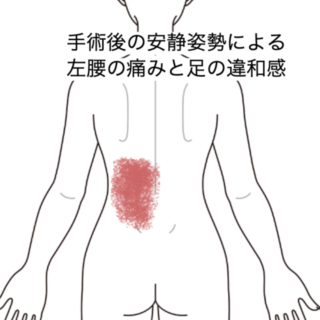 鍼灸の症例「手術後の安静姿勢による左腰の痛みと足の違和感」（JR品川駅／東京都品川区）