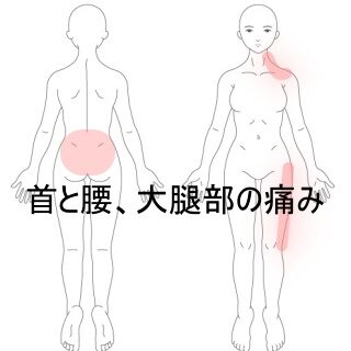 鍼灸の症例「立ち仕事による左頸部・腰部・大腿部の痛みと緊張」（東室蘭駅）