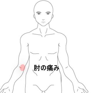 鍼灸の症例「物を持つと痛む右肘内側上顆付近の痛み」（東室蘭駅）