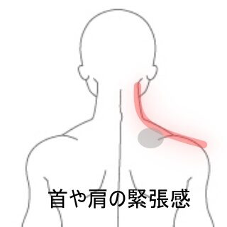鍼灸の症例「起床時から始まった右首と肩の境目の強い緊張感と動作制限」（東室蘭駅）
