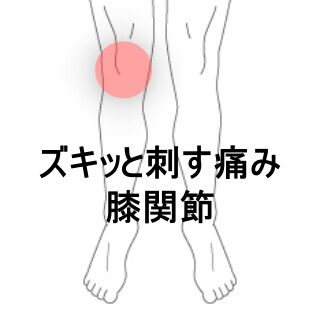 鍼灸の症例「柔道部員の右膝前面のズキッとした痛み」（東室蘭駅）