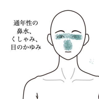 鍼灸の症例「一年中続く鼻水・くしゃみ・目のかゆみ」（神戸市須磨区）