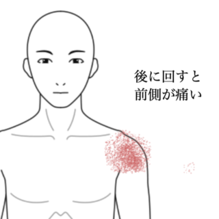 鍼灸の症例「背中を掻く時に感じる左肩前面の痛み」（神戸市須磨区）