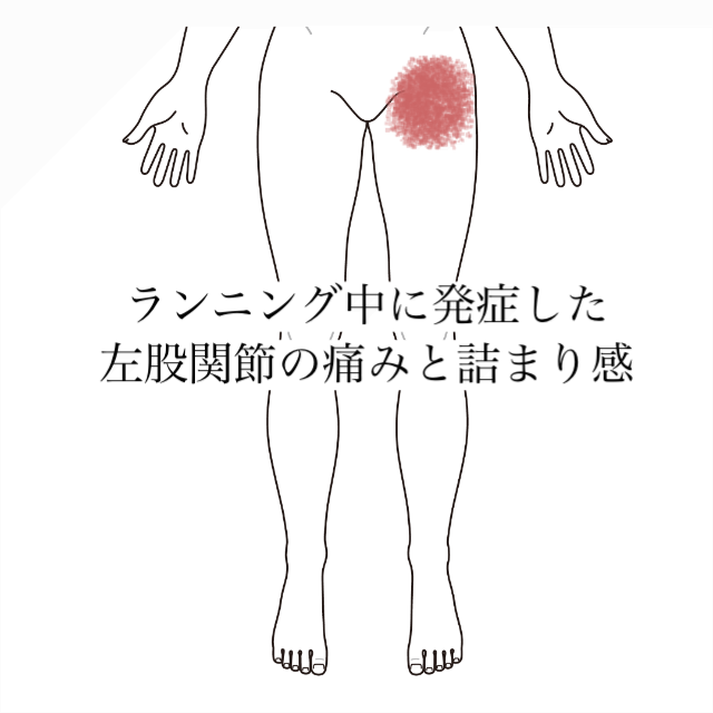 ランニング中に発症した左股関節の痛みと詰まり感｜大腿の痛み、鼠径部