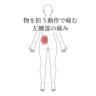 鍼灸の症例「物を拾う動作で痛む左腰部の痛み」（清澄白河）