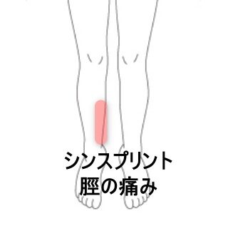鍼灸の症例「ソフトテニス中に発症したシンスプリントの痛みと圧痛」（東室蘭駅）