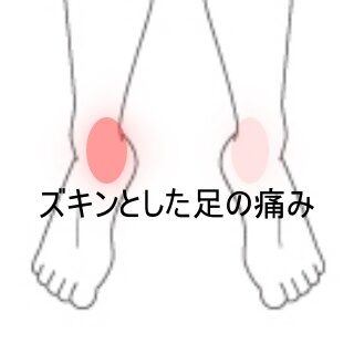 鍼灸の症例「走るとズキンと響く両側後脛骨筋の痛み」（東室蘭駅）
