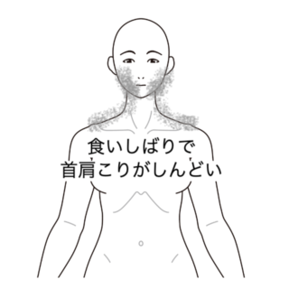 鍼灸の症例「食いしばりが強く首肩こりがしんどい」（清澄白河）