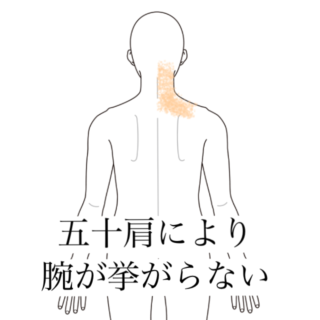 鍼灸の症例「右首を向くと詰まる感じがする」（清澄白河）