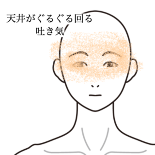 鍼灸の症例「天井がぐるぐる回る起床時のめまい」（神戸市須磨区）