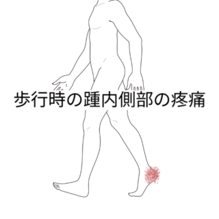 鍼灸の症例「踵部内側の疼痛」（勝田駅）