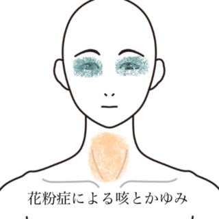 鍼灸の症例「薬を手放せなかった花粉症症状」（群馬県伊勢崎市）