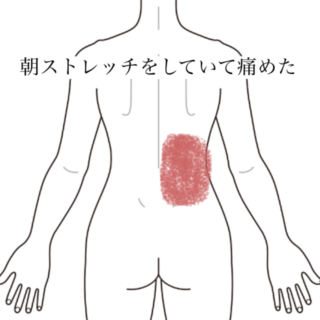 鍼灸の症例「ストレッチ中にピキッと痛めた右腰の痛みと回旋制限」（群馬県伊勢崎市）