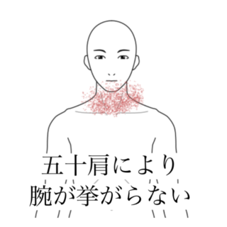 鍼灸の症例「喉の痛みと止まらない咳で夜眠れない」（清澄白河）
