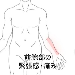 鍼灸の症例「ゴルフのフォーム変更後に生じた前腕の痛みと緊張感」（東室蘭駅）