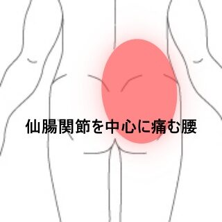 鍼灸の症例「立つ・座る動作で痛む業務負担増加後の腰痛」（東室蘭駅）