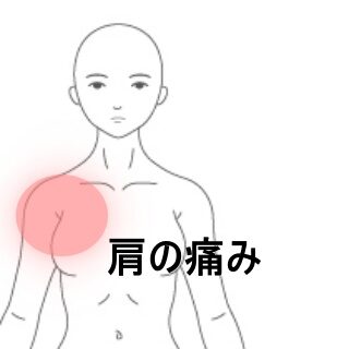 鍼灸症例|バレーボールのアタック動作で痛む右肩|東室蘭駅|すのさき鍼灸整骨院