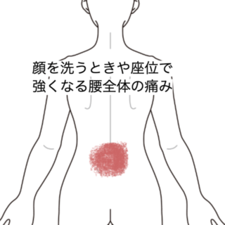 鍼灸の症例「顔を洗うときや座位で強くなる腰全体の痛み」（JR品川駅／東京都品川区）