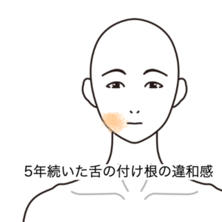 鍼灸の症例「5年続いた舌の付け根の違和感」（群馬県伊勢崎市）