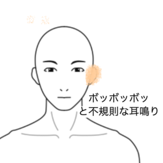 鍼灸の症例「「ぼっぼっぼ」と鳴る左耳の耳鳴り」（群馬県伊勢崎市）