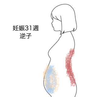 鍼灸の症例「妊娠31週で逆子、お腹の張りと背中の痛み」（群馬県伊勢崎市）