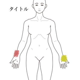 鍼灸の症例「育児と家事で悪化した右手首の痛みと左母指球の痙攣」（黒川駅／名古屋市北区）