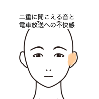 鍼灸の症例「二重に聞こえる音と電車放送への不快感」（JR品川駅／東京都品川区）