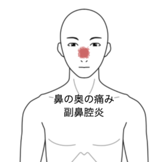 鍼灸の症例「旅行後に続く鼻の奥の痛みともやもや感」（群馬県伊勢崎市）