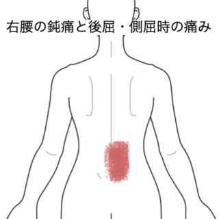 鍼灸の症例「右腰の鈍痛と後屈・側屈時の痛み」（JR品川駅／東京都品川区）